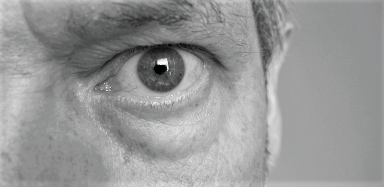 Comment enlever les poches sous les yeux ? Nos astuces & conseils